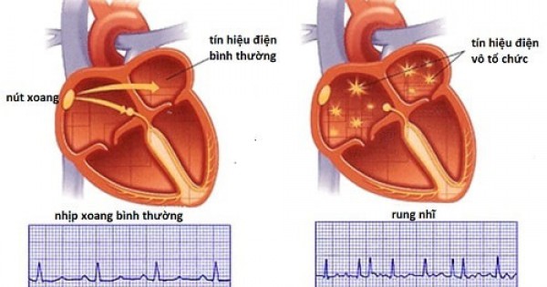 Nhịp tim bình thường của trẻ em là bao nhiêu? Lưu ý khi nhịp tim không bình thường