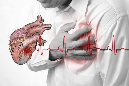 Chẩn đoán bệnh suy tim như thế nào?