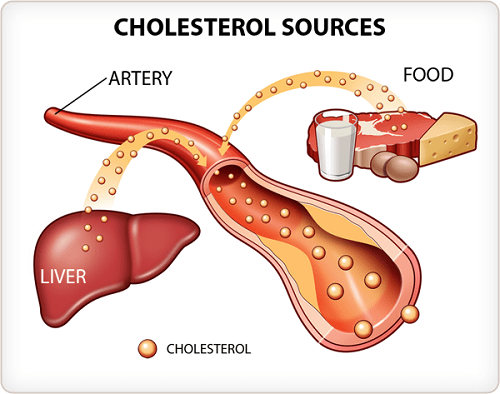 Những người mắc cholesterol cao thường mắc bệnh tim mạch