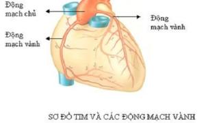 Bệnh mạch vành là gì?
