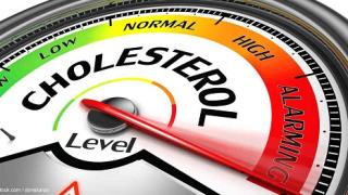 Có phải Cholesterol nào cũng gây xơ vữa động mạch?