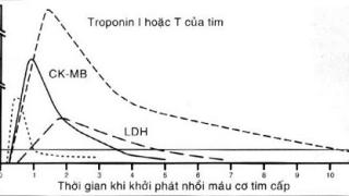 Dấu ấn sinh học trong huyết thanh của bệnh nhân nhồi máu cơ tim