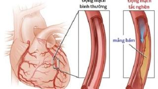 Bệnh suy tim trái- Nguyên nhân và triệu chứng
