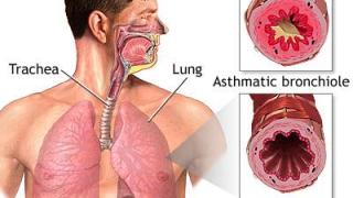 Thuốc trị hen cho người bệnh tim mạch