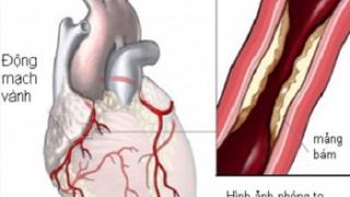 Phát hiện sớm và phòng ngừa bệnh mạch vành
