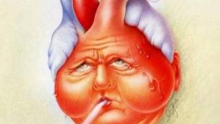 Sự khác nhau giữa bệnh nhồi máu cơ tim và suy tim