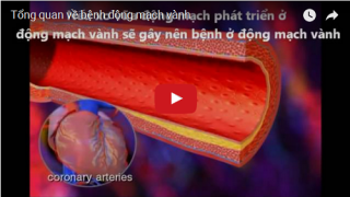 Tổng quan về bệnh động mạch vành 