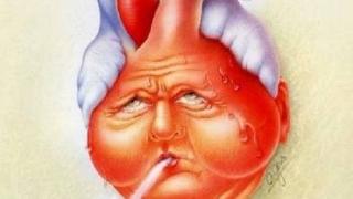 Tỷ lệ nhồi máu cơ tim ở Việt Nam, con số đáng báo động