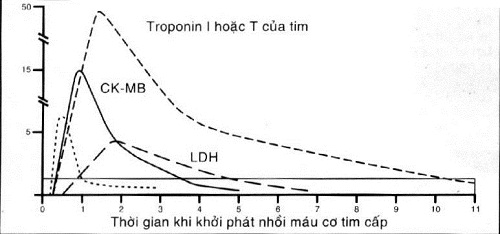 Xét nghiệm men tim giúp chẩn đoán nhồi máu cơ tim