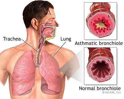 Thuốc trị hen cho người bệnh tim mạch